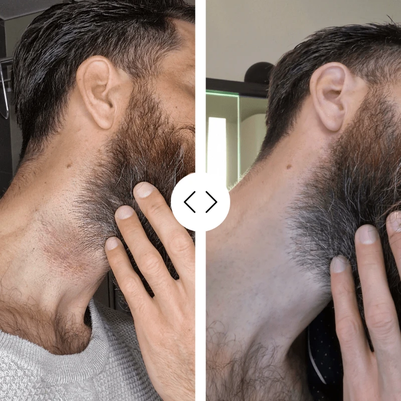 Vollbart Bundle 2 Vollbart Bundle – Bild 2